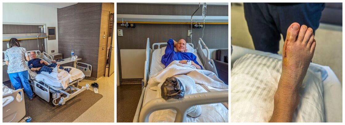 Three post-surgery photos: A nurse checks on Brent in his hospital room, Brent in his bed recovering, and a photo of Brent's foot after the surgery