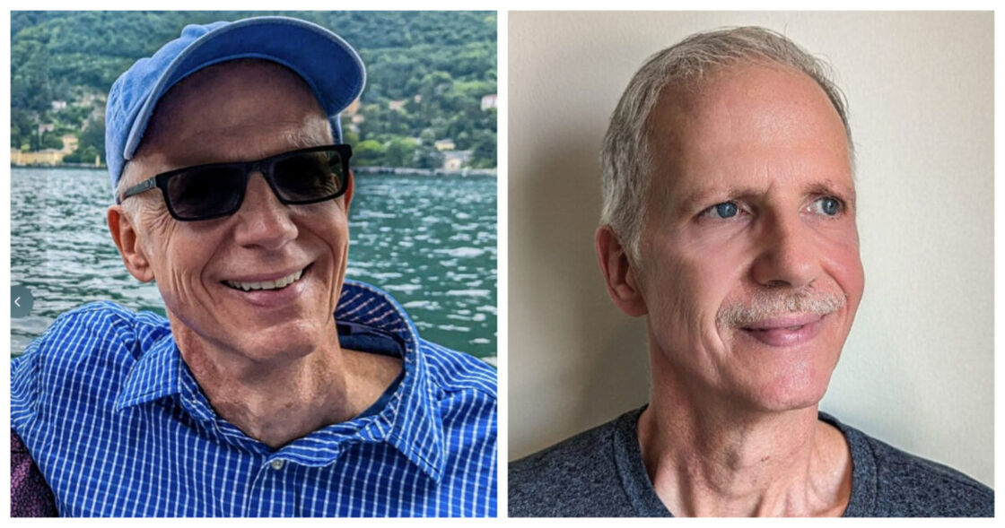 Michael Jensen before and after cosmetic surgery