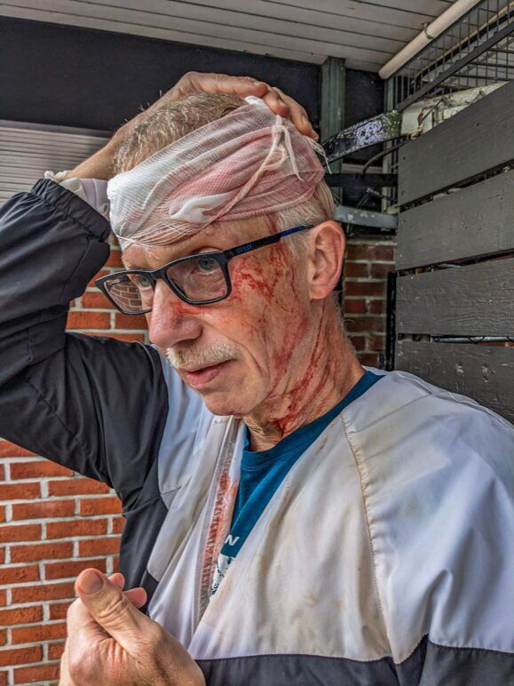 Michael with gauze wrapped his head, blood all over his face and neck. Michael Jensen with blood all over his face and a bandage wrapped around his head