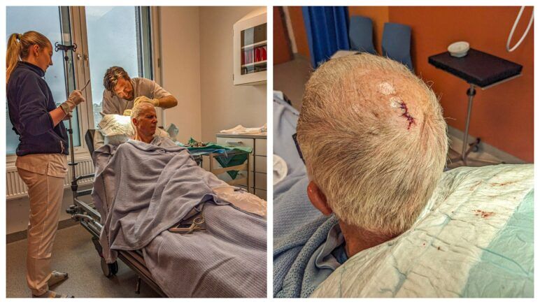 Left panel shows me getting stitches, the right a picture of my sutured skull. 